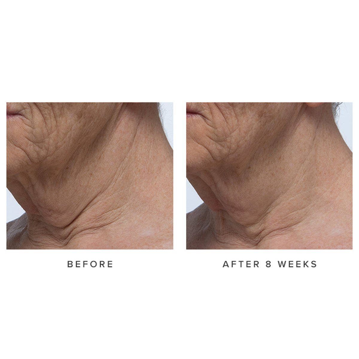 Ageless Revitalizing Neck Cream Moisture Support Neck Cream for Everyday Use