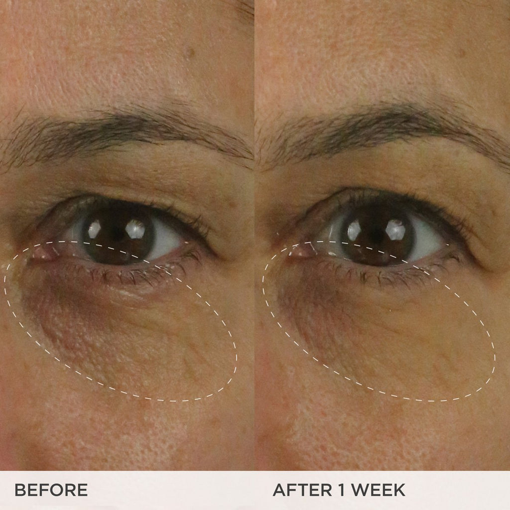 The Brightening Eye Cream A Range of Skin Types Eye Cream for Everyday Use