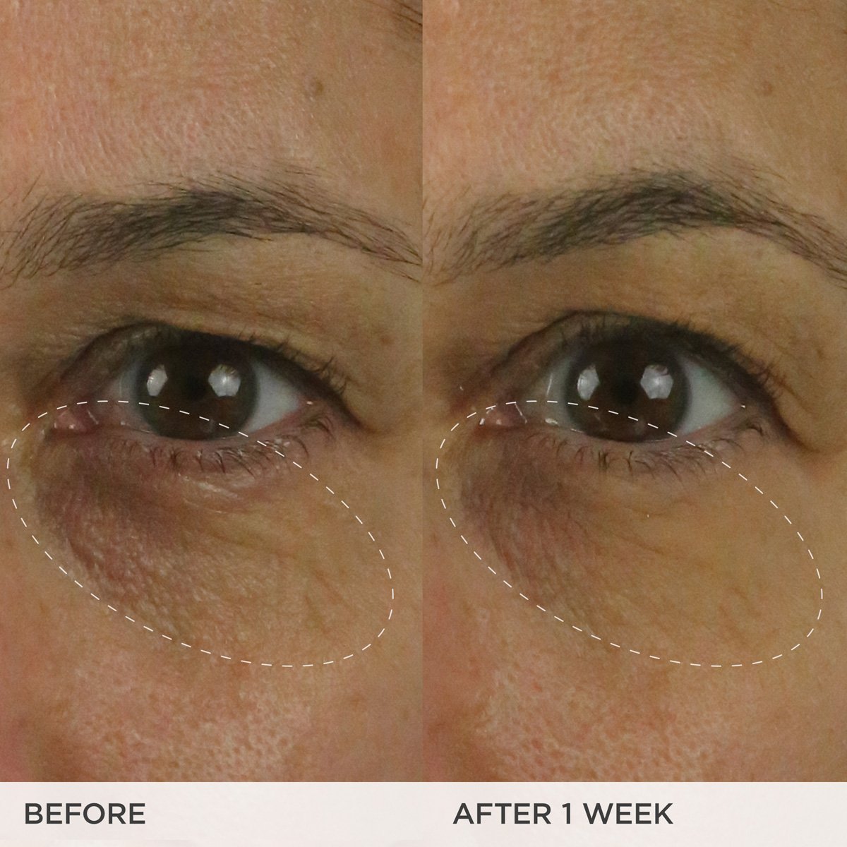 The Brightening Eye Cream A Range of Skin Types Eye Cream for Everyday Use
