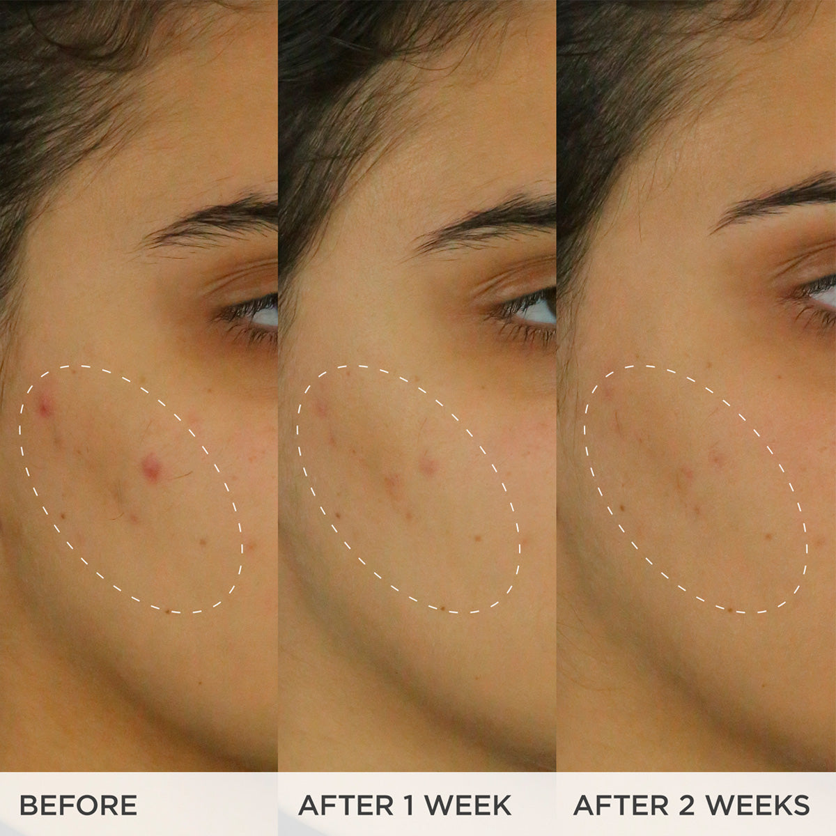 The Brightening Serum A Range of Skin Types Face Serum for Everyday Use