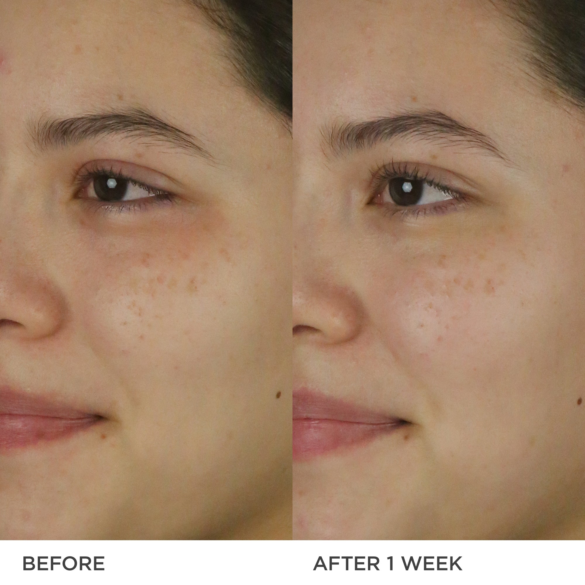 The Dewy Milk Moisturizer Combination to Oily Skin Face Moisturizer for Everyday Use