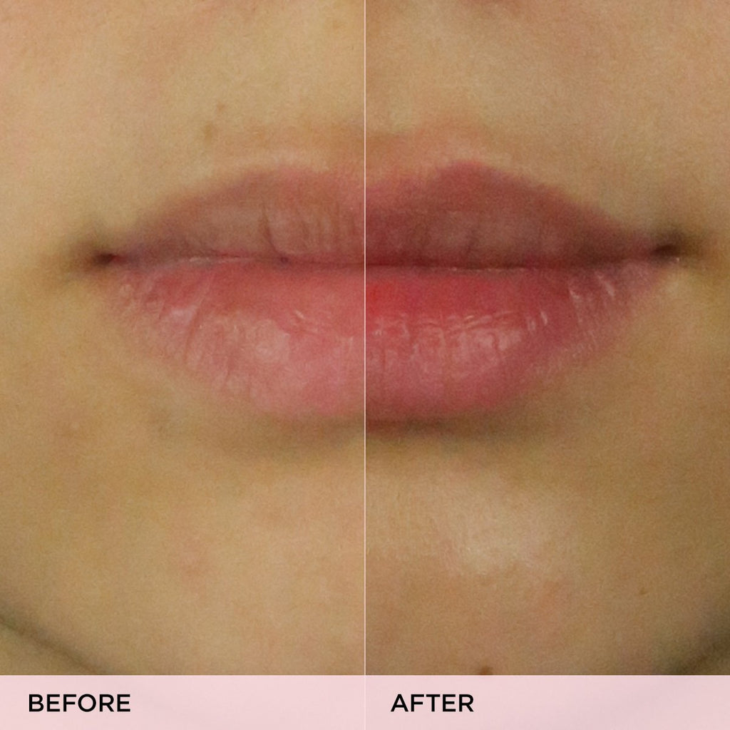 The Kissu Lip Scrub Moisture Support Lip Scrub for Everyday Use