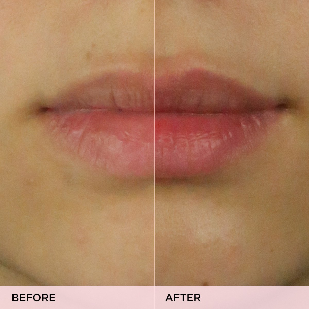 The Kissu Lip Scrub Moisture Support Lip Scrub for Everyday Use