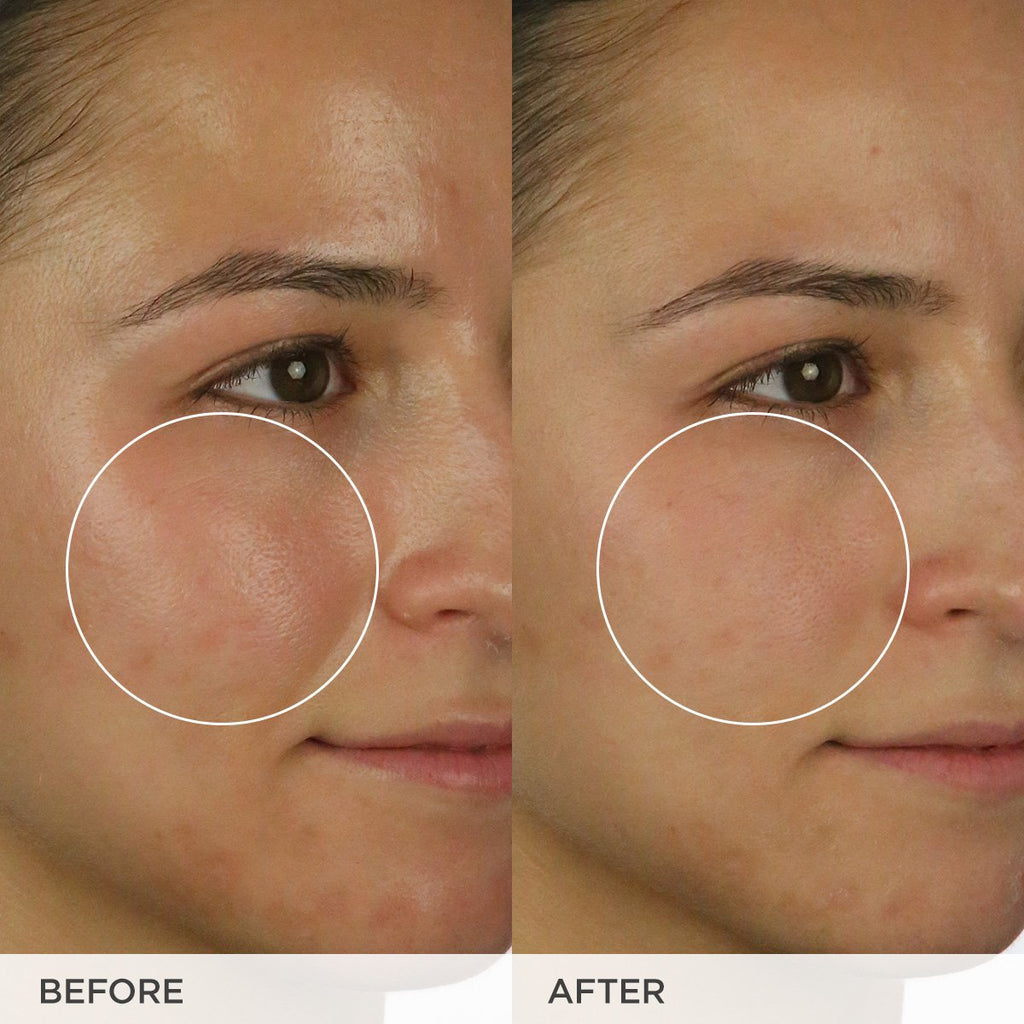 The Matcha Cleanse A Range of Skin Types Facial Cleanser for Everyday Use