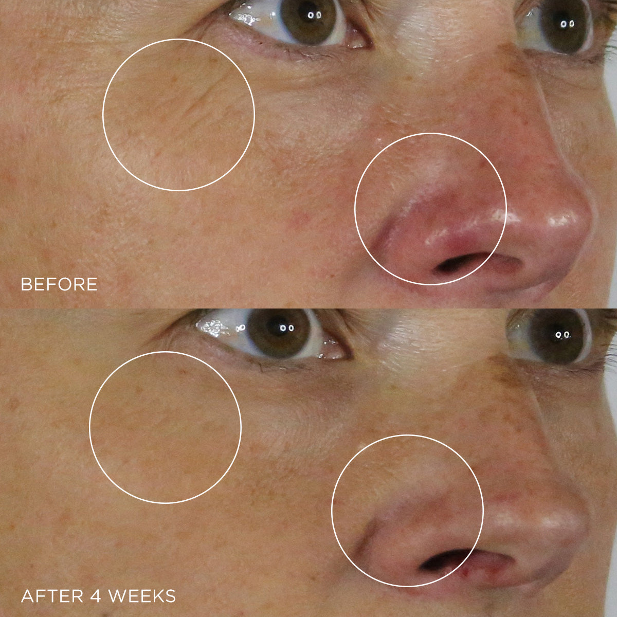 The Silk Serum Moisture Support Face Serum for Everyday Use